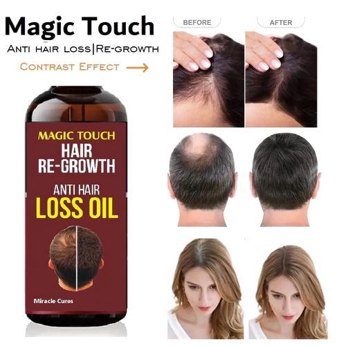 Magic Touch Hair Regrowth Oil
