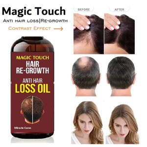 Magic Touch Hair Regrowth Oil