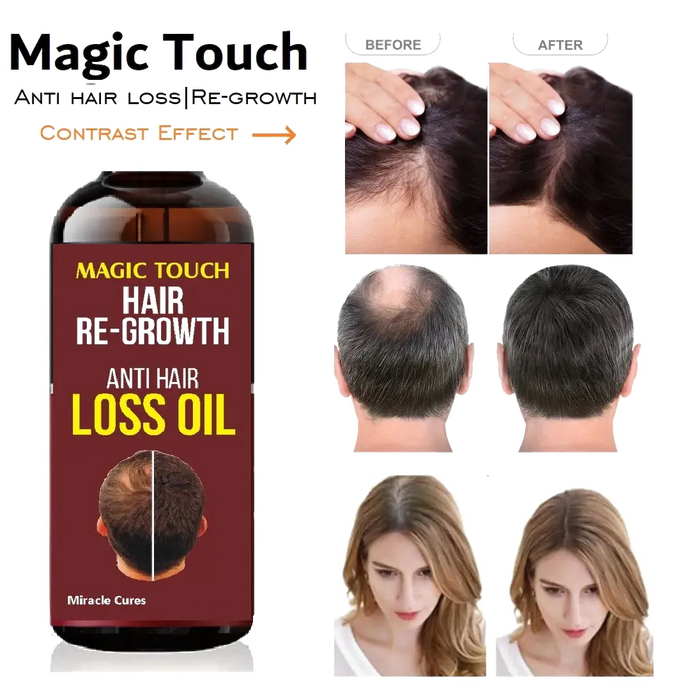 Magic Touch Hair Regrowth Oil