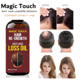 Magic Touch Hair Regrowth Oil